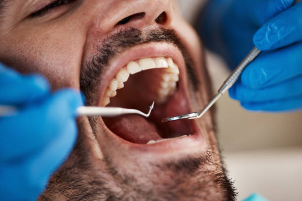 Best Urgent Care for Lost Fillings or Crowns in Paulding, OH