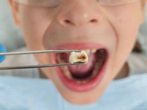 Best Same-Day Emergency Dental Services in Paulding, OH