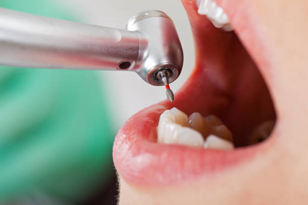 Best Emergency Denture Repair in Paulding, OH